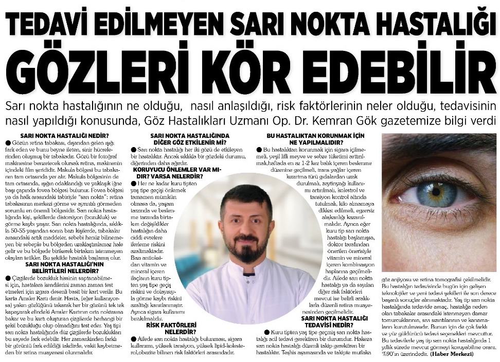 Tedavi Edilmeyen Sarı Nokta Hastalığı Gözleri Kör Edebilir